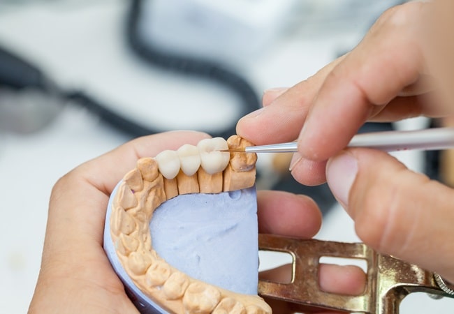 prosthodontics-dr-dove-dental-office