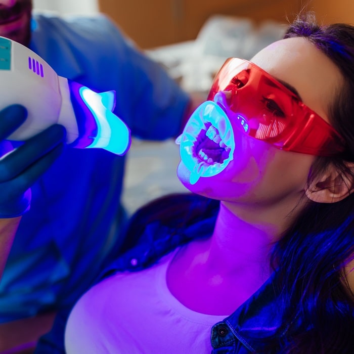 teeth-whitening-in-dr-dove-dental-office